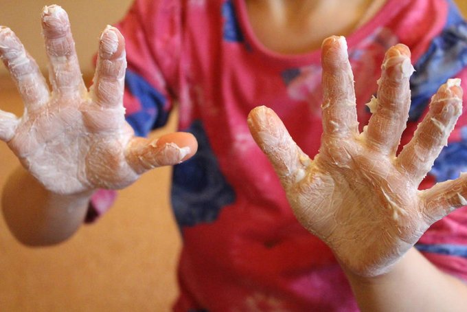 Kindergarten_Igel_Sensorische_Integration